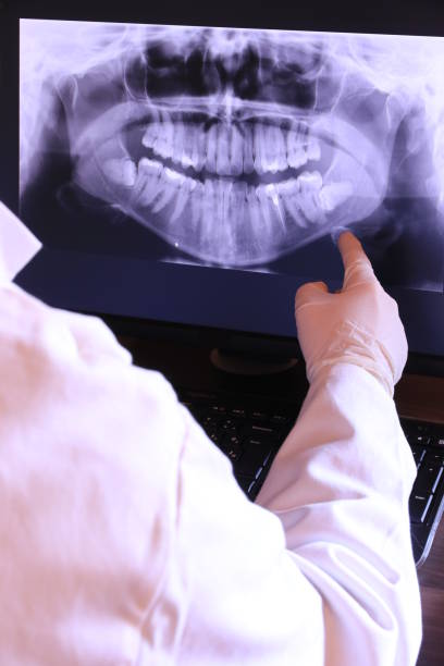 Best Emergency Dentist for Lost Fillings or Crowns in Crenshaw, MS